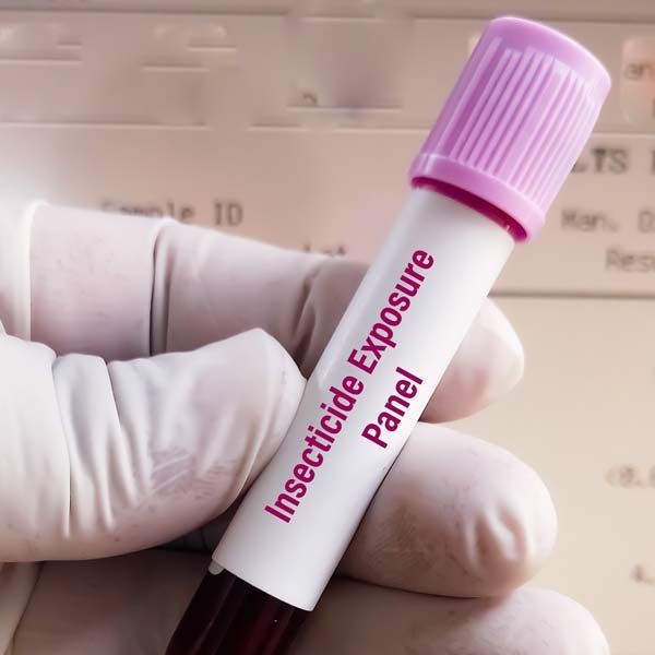 A person is holding a test tube that says insecticide exposure panel