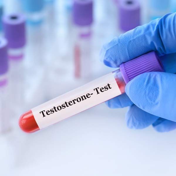 A person is holding a test tube that says testosterone test representing Advanced Testosterone Treatments Serving Patients in Morris Plains New Jersey and Manhattan New York