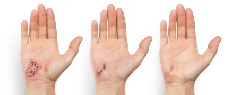 How Orthobiologic Treatments Assist Tissue Healing