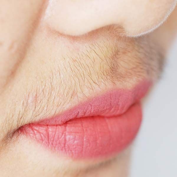 A close-up of a woman's lips with a mustache needs Advanced Diolaze Hair Removal, Serving Patients in Morris Plains, New Jersey, and Manhattan, New York