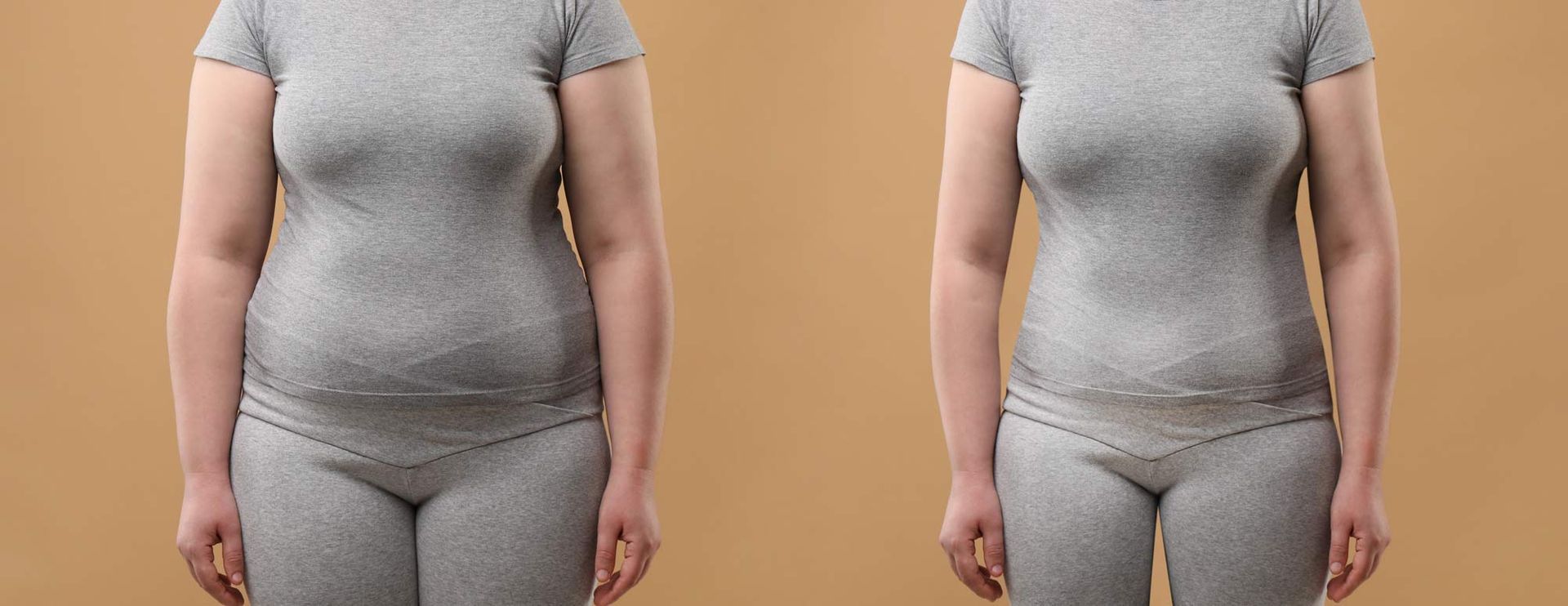 A woman is shown before and after losing weight with Doctor Managed Hormone Therapy for Weight Loss by Victory Medical Institute in Morris Plains, New Jersey, and Manhattan, New York