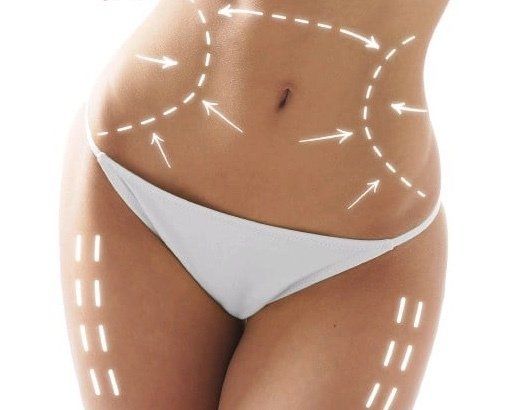 Silhouette redessinée grâce à  cryolipolyse au ventre, à la taille et à la culotte de cheval