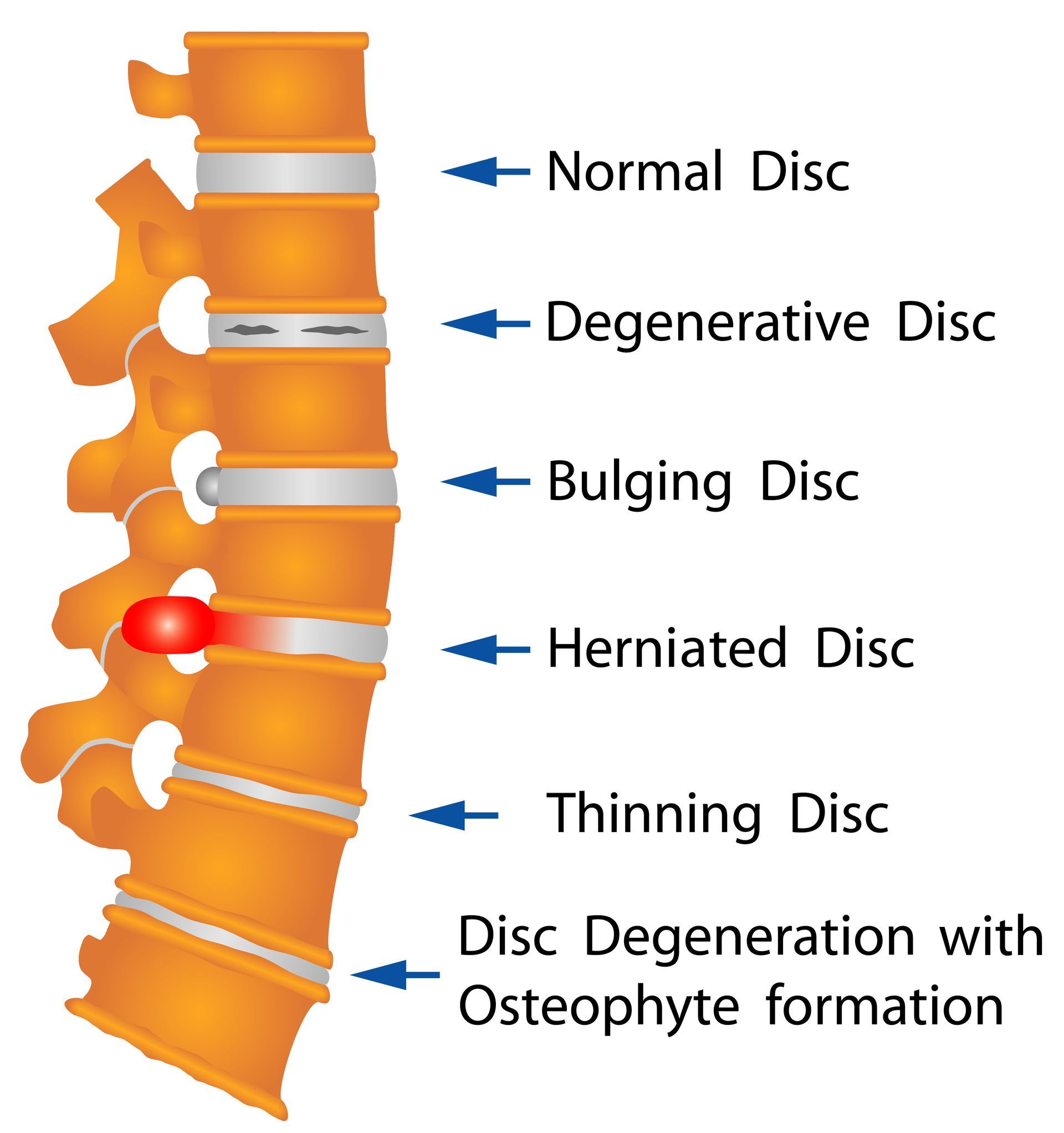 Spinal Diagram