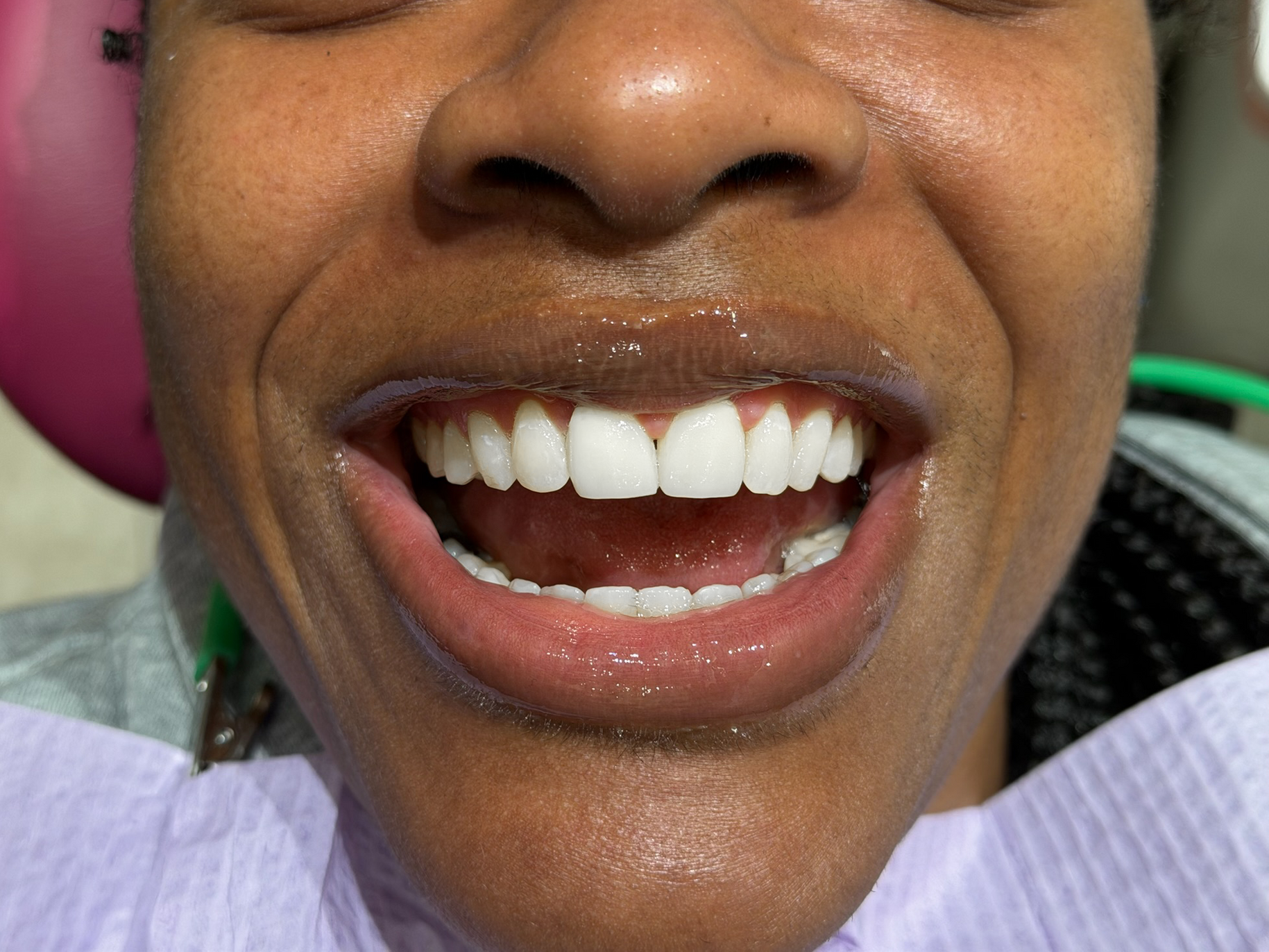 A close up of a man 's mouth with white teeth.