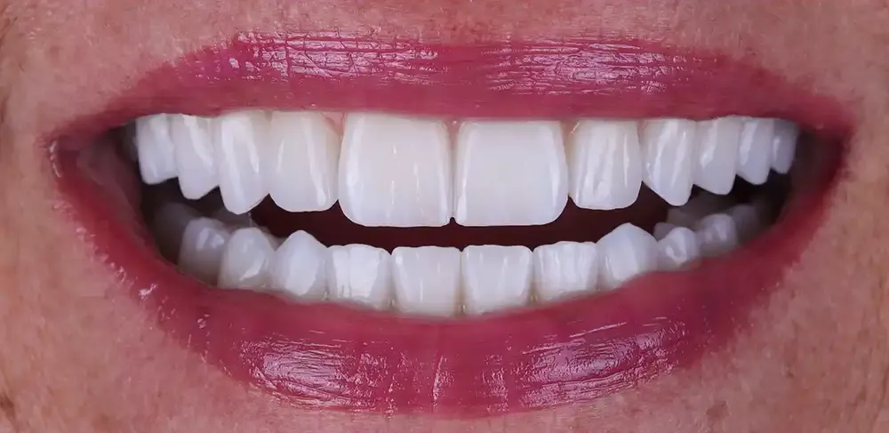 A close up of a man 's mouth with a beard and white teeth.