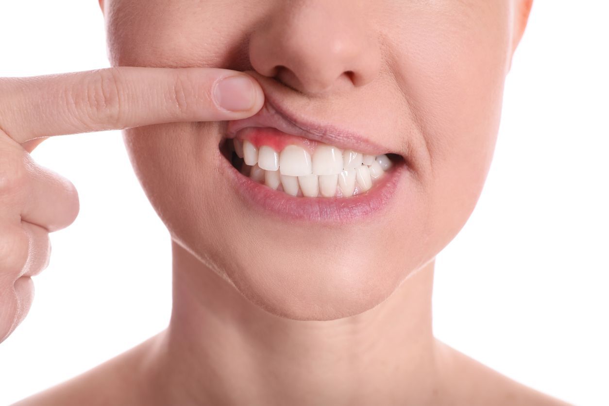 Dental pain with gum disease
