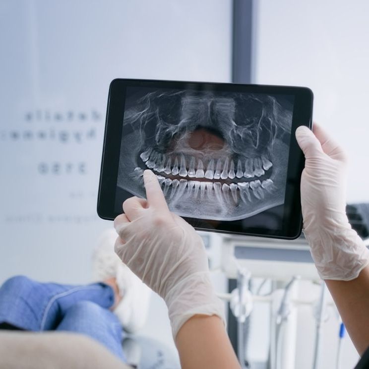 A person is holding a tablet with a picture of a dental x-ray