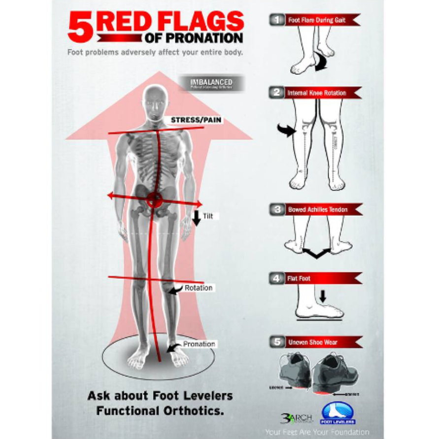 A Diagram Of A Human Figure Pointing The 5 Red Flags Of Pronation — Trinity Family Chiropractic In Cairns, QLD
