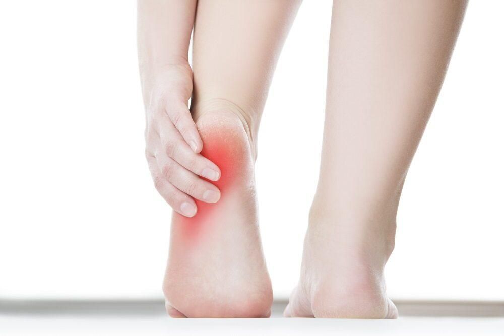 A Person Lifting Up Their Heel Showing A Sore Spot — Trinity Family Chiropractic In Cairns, QLD