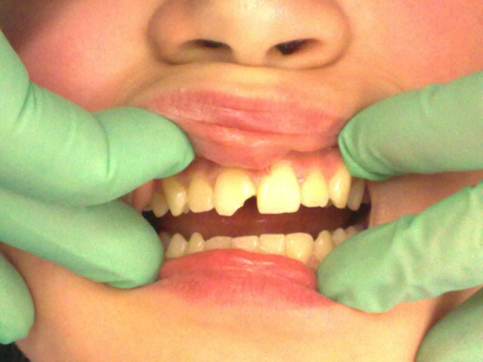 Dental treatments Crawley Dental Clinic