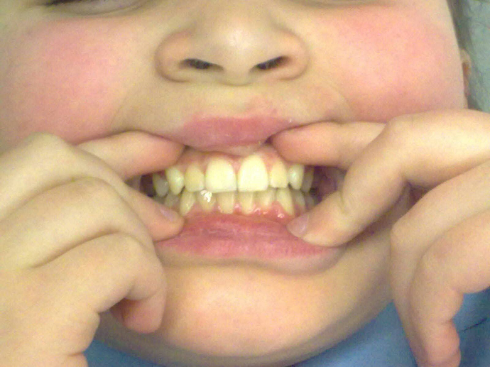 Dental treatments Crawley Dental Clinic