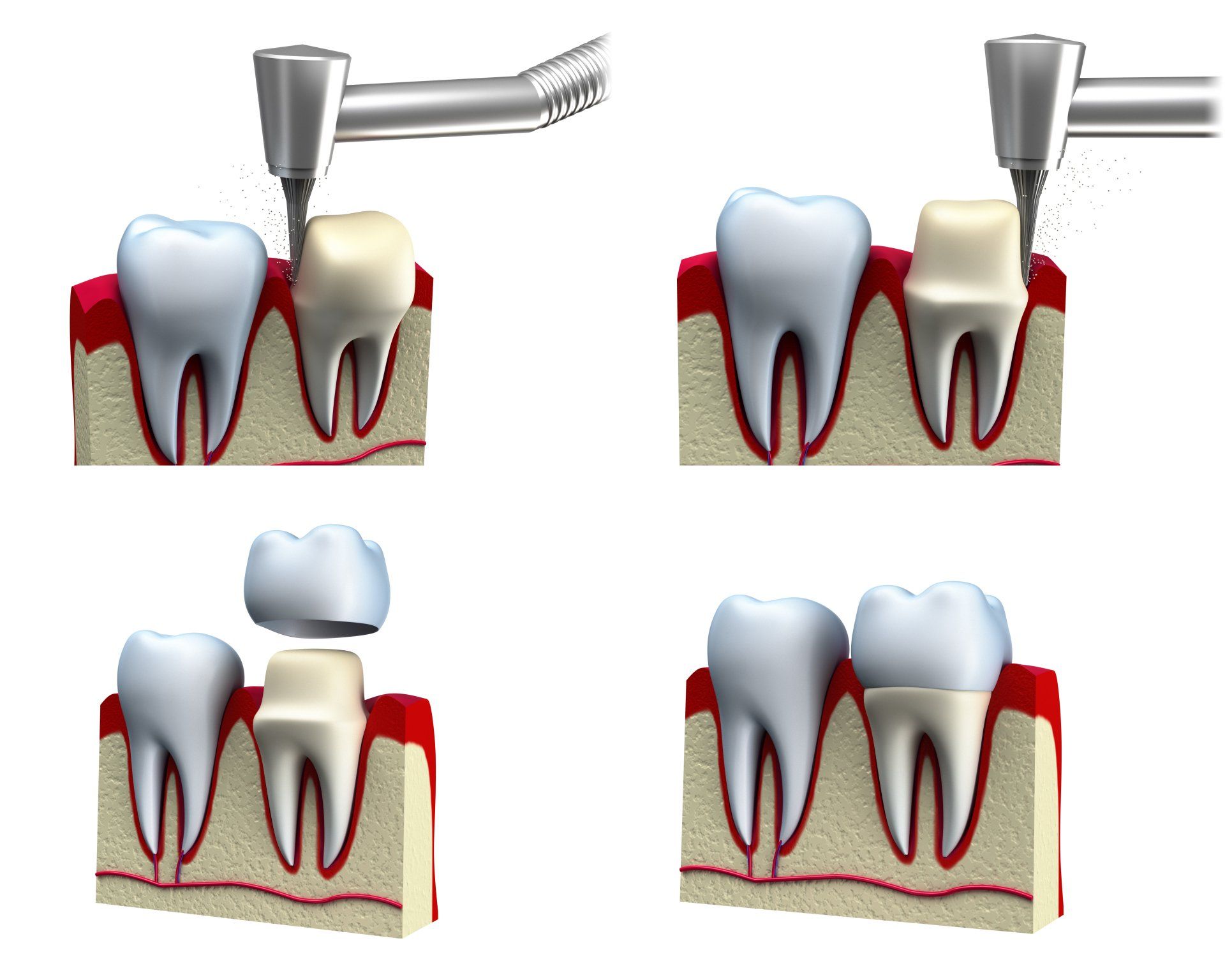 Dental treatments Crawley Dental Clinic