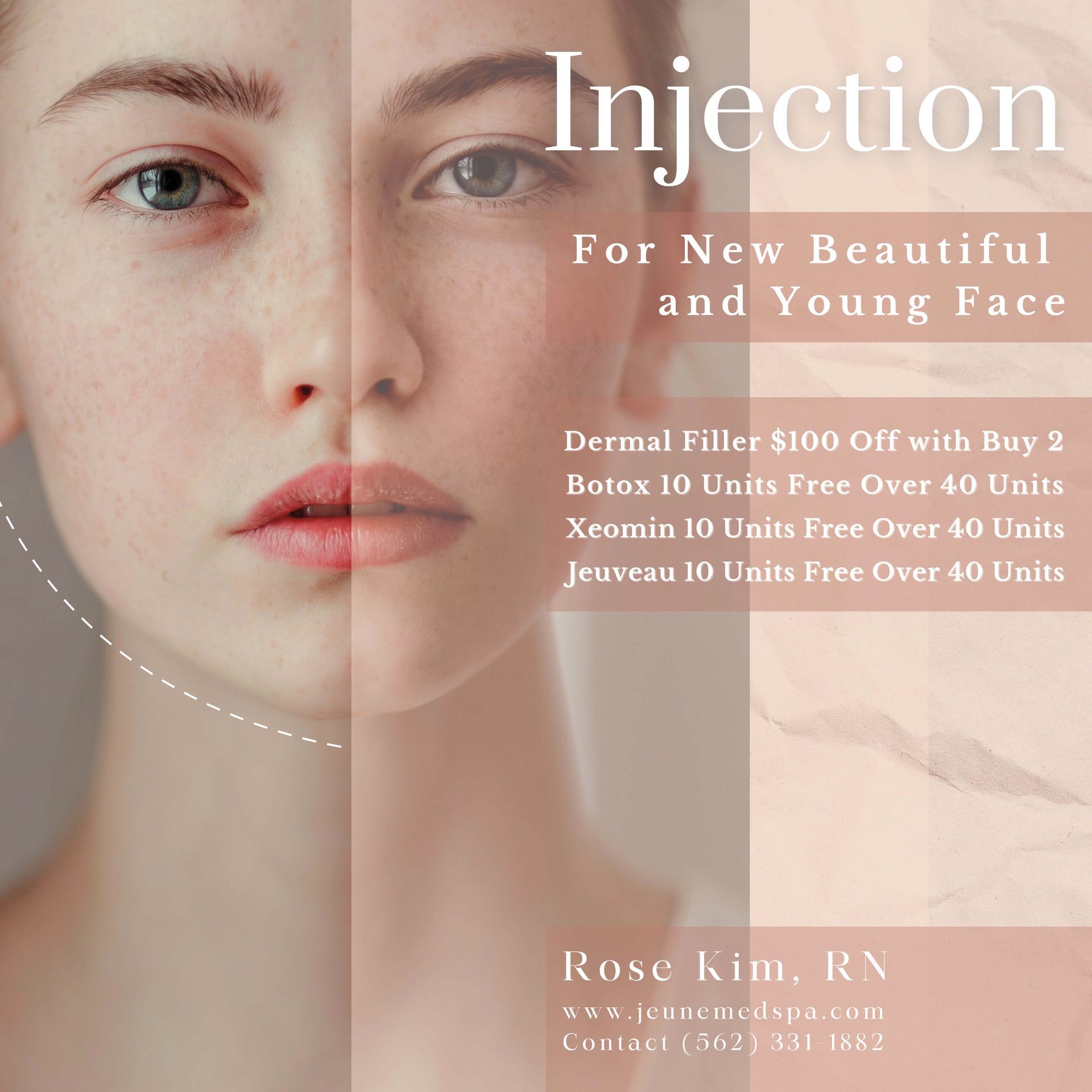 An ad for injections for new beautiful and young faces