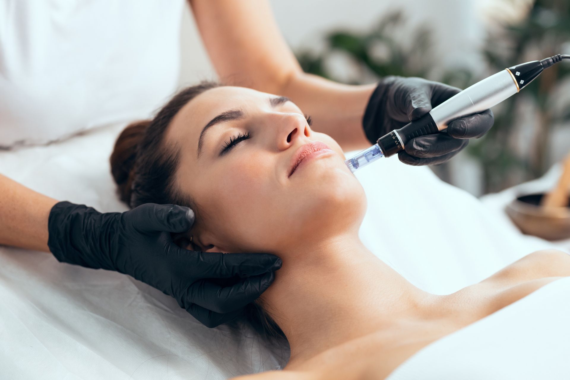 A woman, laying on a cosmetologist table, receives a skin treatment with a dermapen.