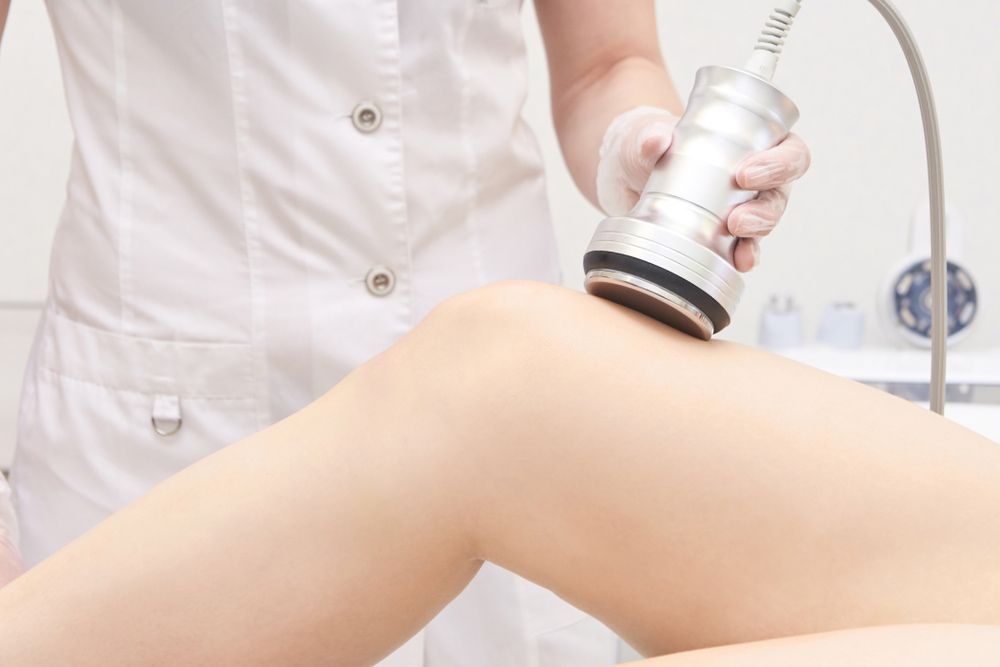 A Woman is Getting a Cavitation Treatment on her leg — Bersantai Medispa in Toukley, NSW