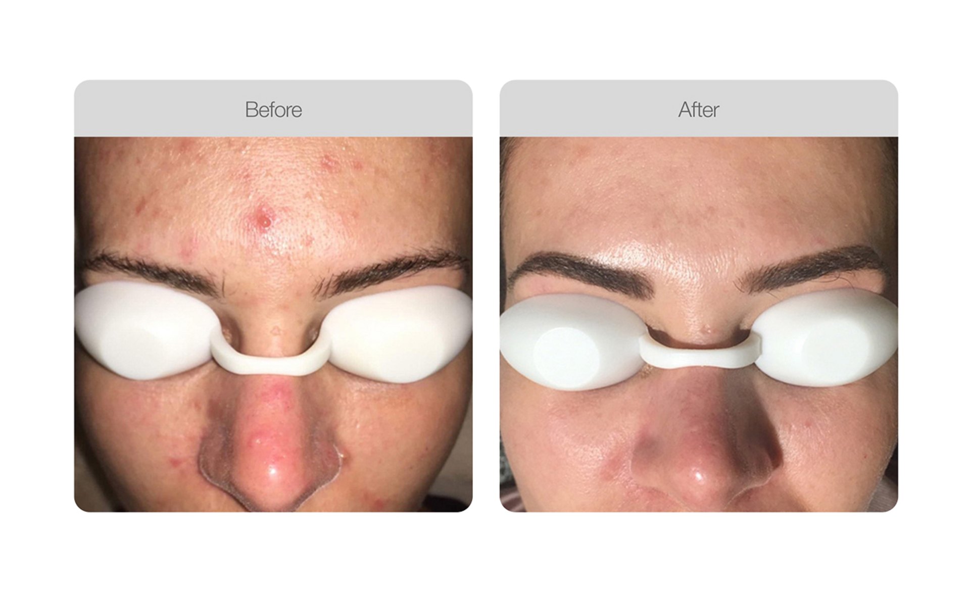 Beautician Washes Woman's Face Using Wet Wipes — Bersantai Medispa in Toukley, NSW