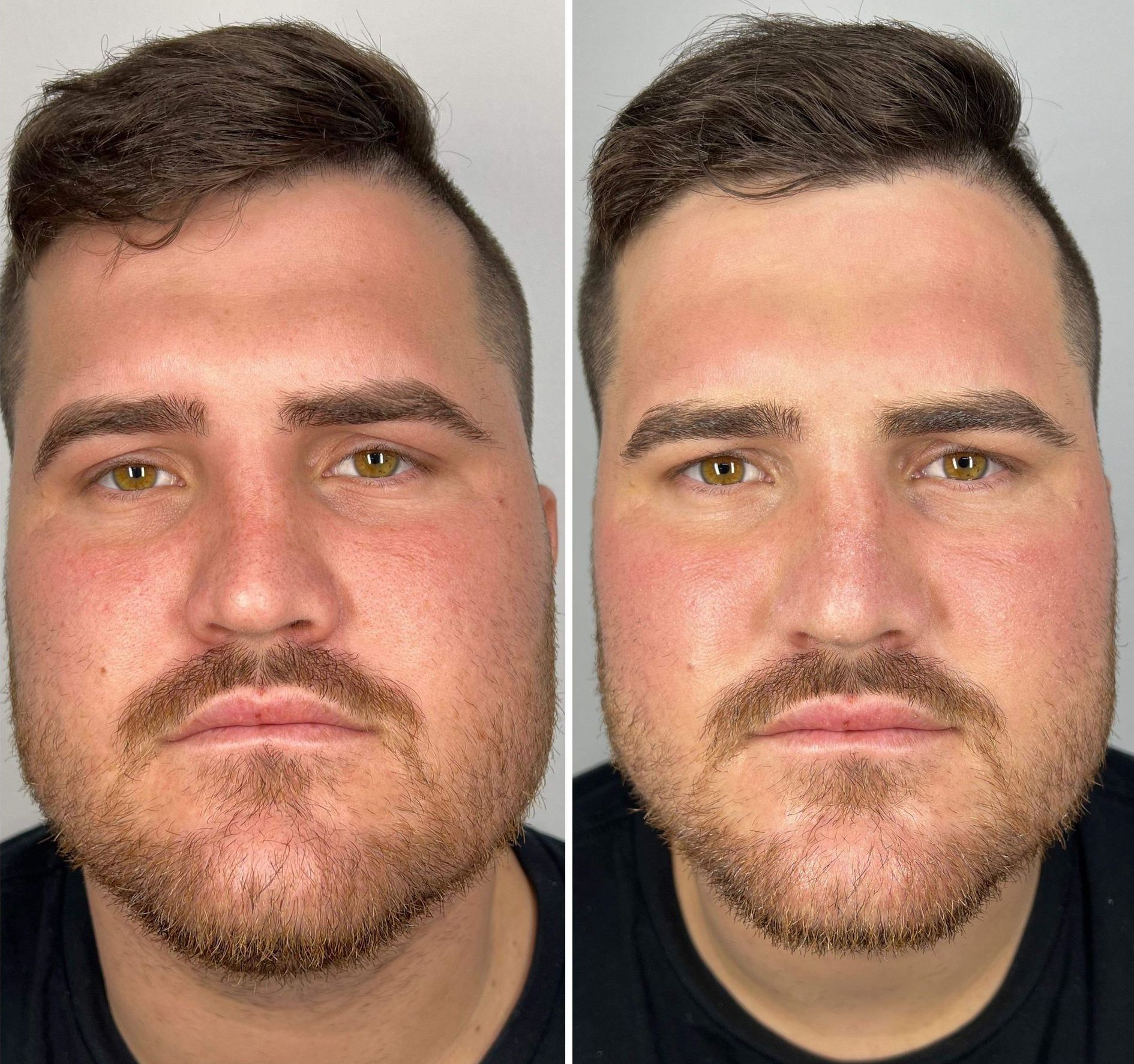 Woman with a Beautiful and Healthy Face — Bersantai Medispa in Toukley, NSW