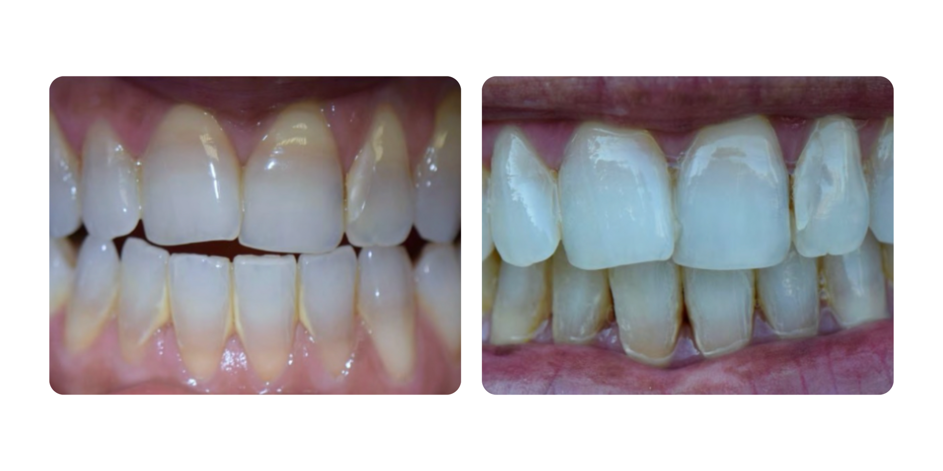 Woman with a Fresh Clean Skin — Bersantai Medispa in Toukley, NSW