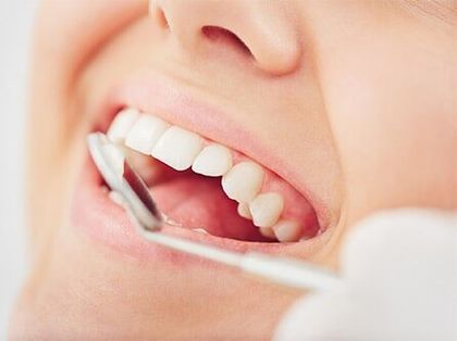 Dental Check Up - Dental Exams in Lynbrook, NY