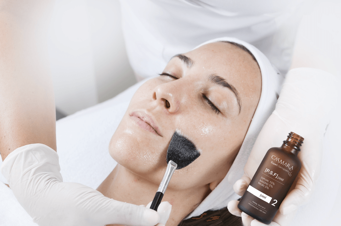 Peeling chimico viso Merate