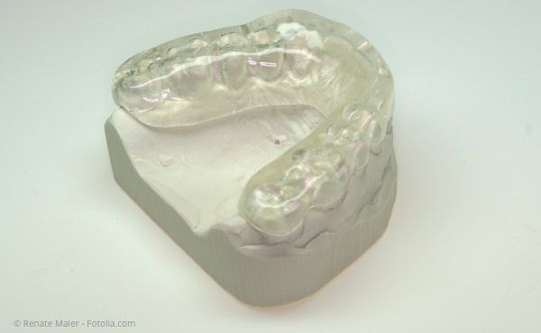 Eine Aufbiss-Schiene, die Störkontakte zwischen den Zähnen ausgleicht und damit Zähneknirschen und -pressen verhindert.