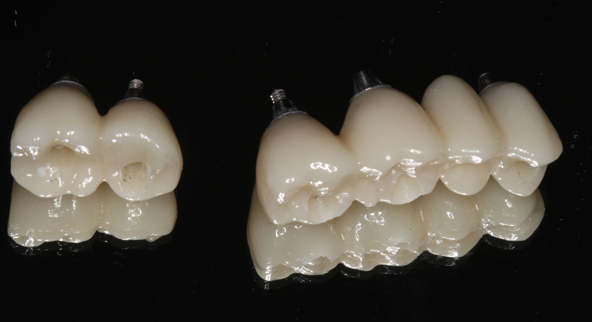 Implant-supported dental bridges