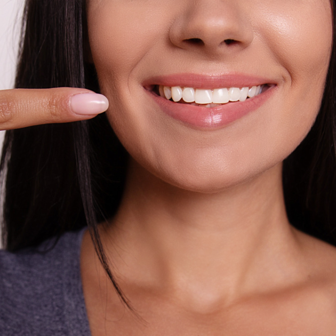 A woman is smiling and pointing at her teeth