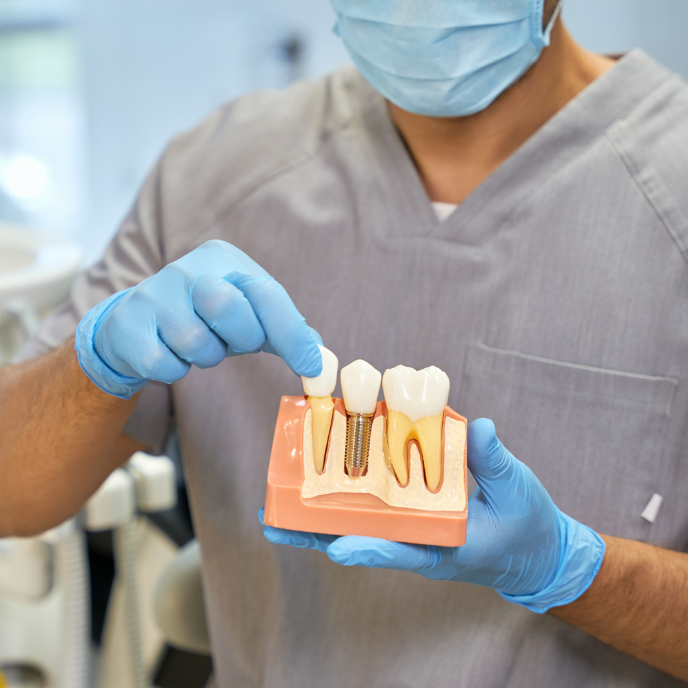 dentist showing dental implant diagram | Best cosmetic dentist in Corpus Christi 78404