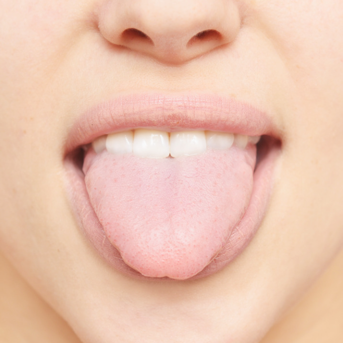 sticking tongue out | gum disease dentist | Corpus Christi TX 78404