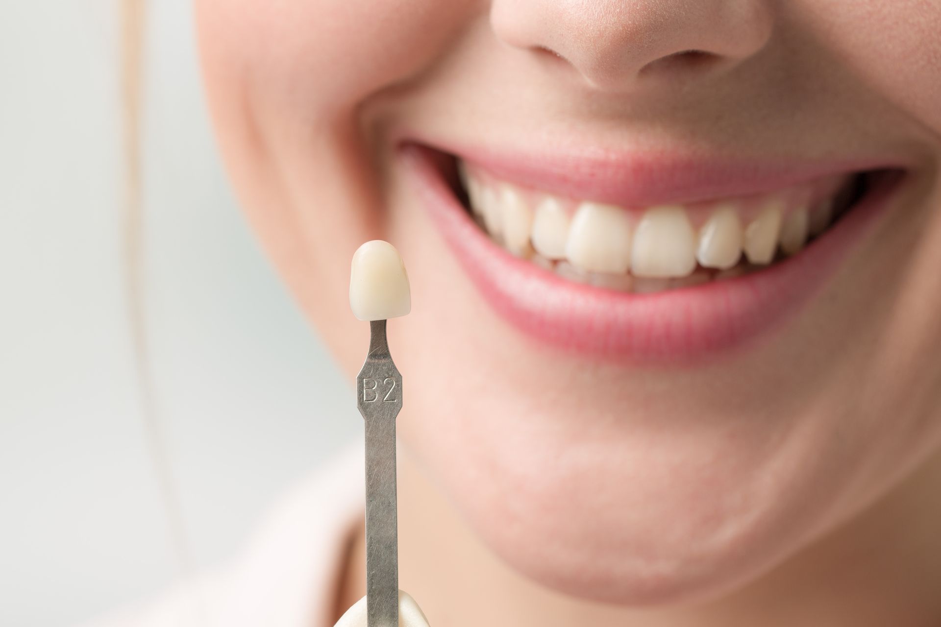 Person smiling with a tooth shade comparison tool, showing white tooth shade.
