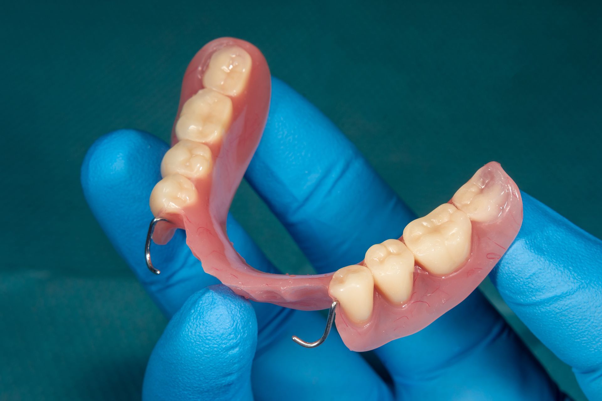 Partial denture held by gloved hand, pink base, white teeth, metal clasps.