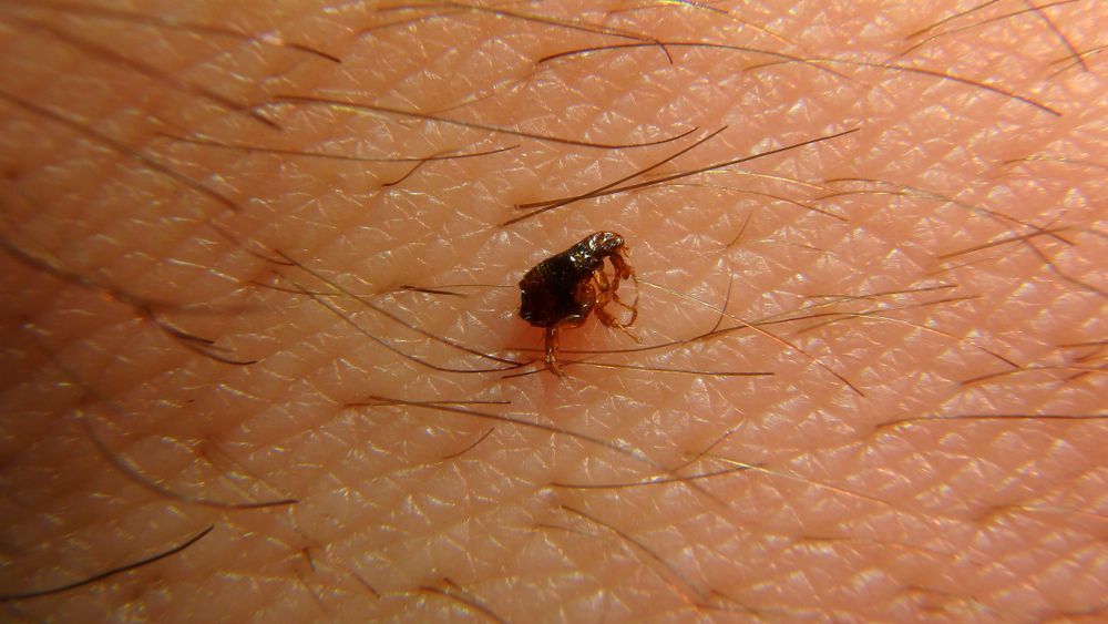 A Flea Is Crawling On A Person 's Skin — ASAP Pest Control in Gumdale, QLD