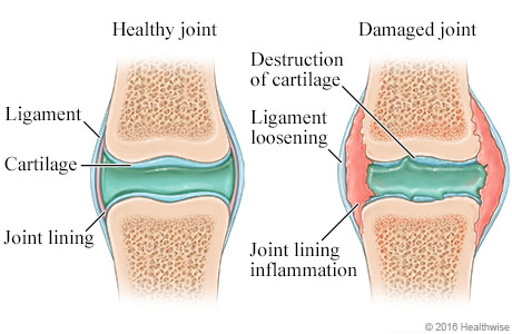 chiropractic joints example