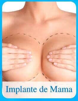 Implante de mama
