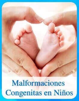 Malformaciones congénitas de niños