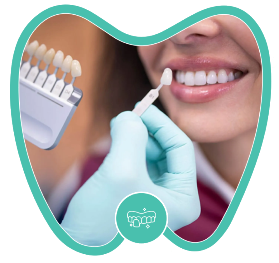 A gloved hand holds a dental shade guide next to a patient’s teeth to match their natural tooth color.