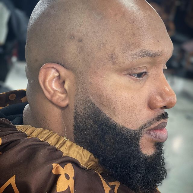 A bald man with a beard is wearing a louis vuitton jacket