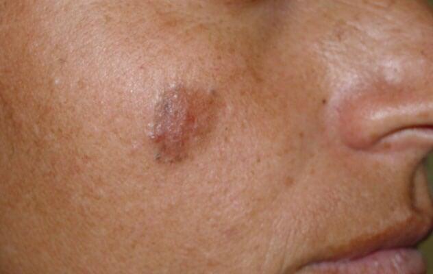 DRA. OLIVIA LUGO RIVERA