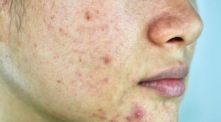 DRA. OLIVIA LUGO RIVERA