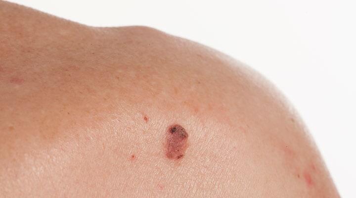 DRA. OLIVIA LUGO RIVERA