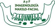 A Y F VISION 3-D