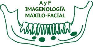 A Y F VISION 3-D