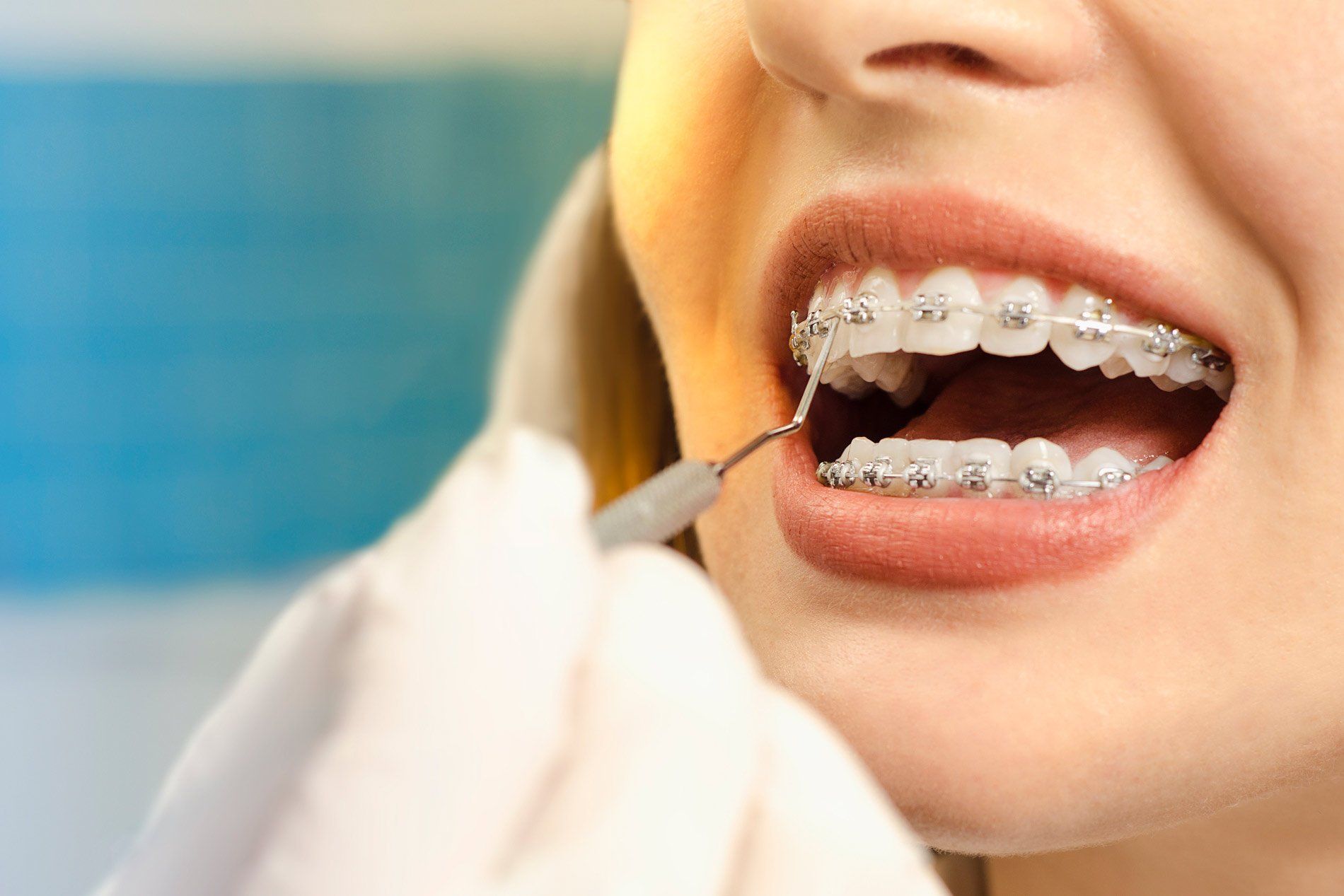 A girl undergoing routine maintenance on her braces near Canningvale