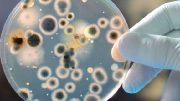 A person is holding a petri dish with bacteria on it.