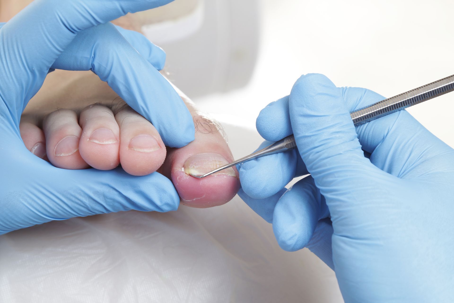 A person's foot being examined with medical tools, gloved hands, close-up.