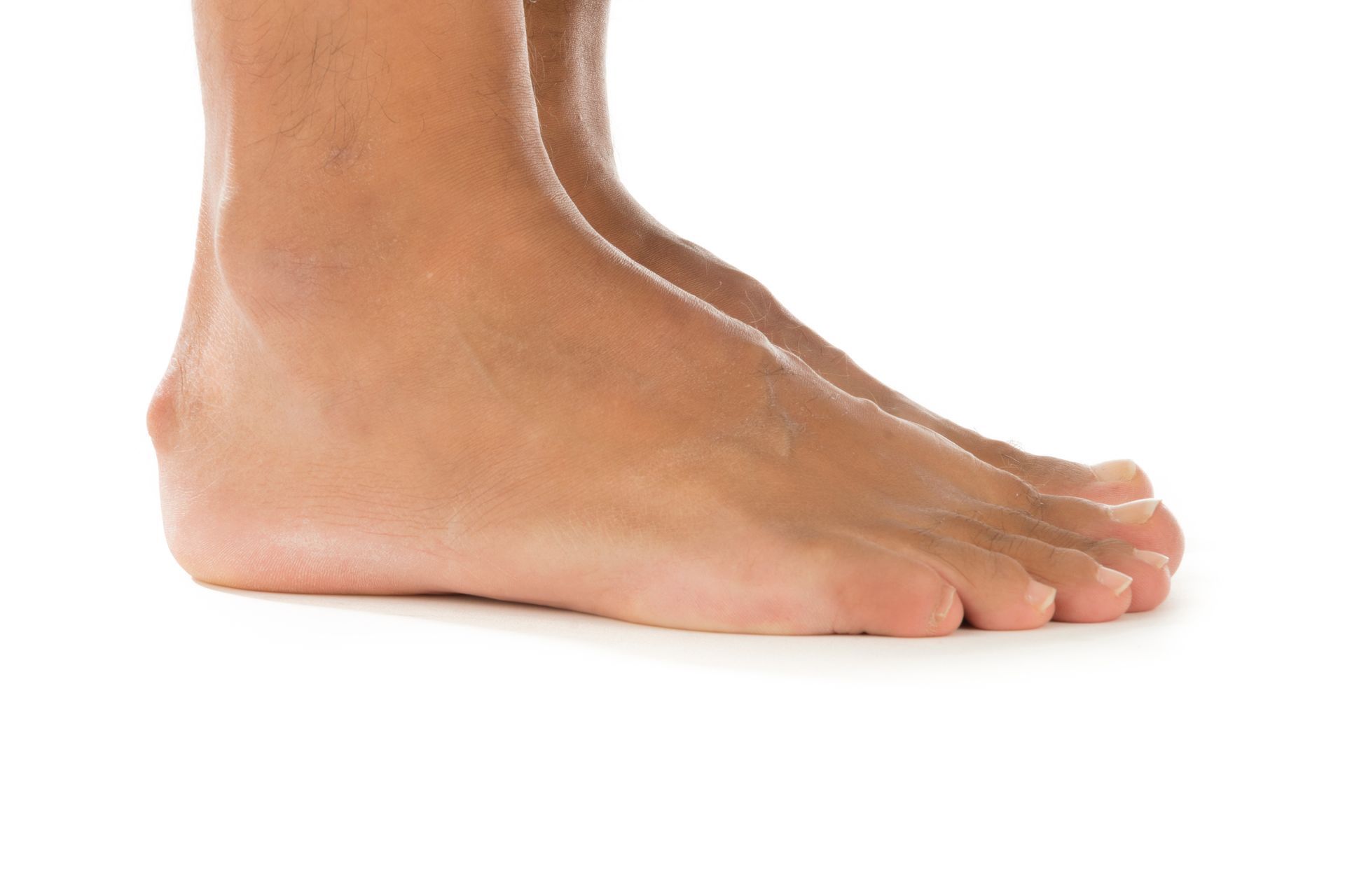 Bare feet on a white surface. One foot is in focus, the other slightly behind.