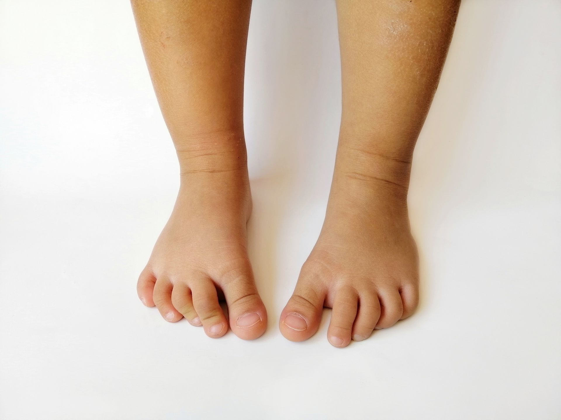 Bare feet with toes pointing forward, on a white surface.