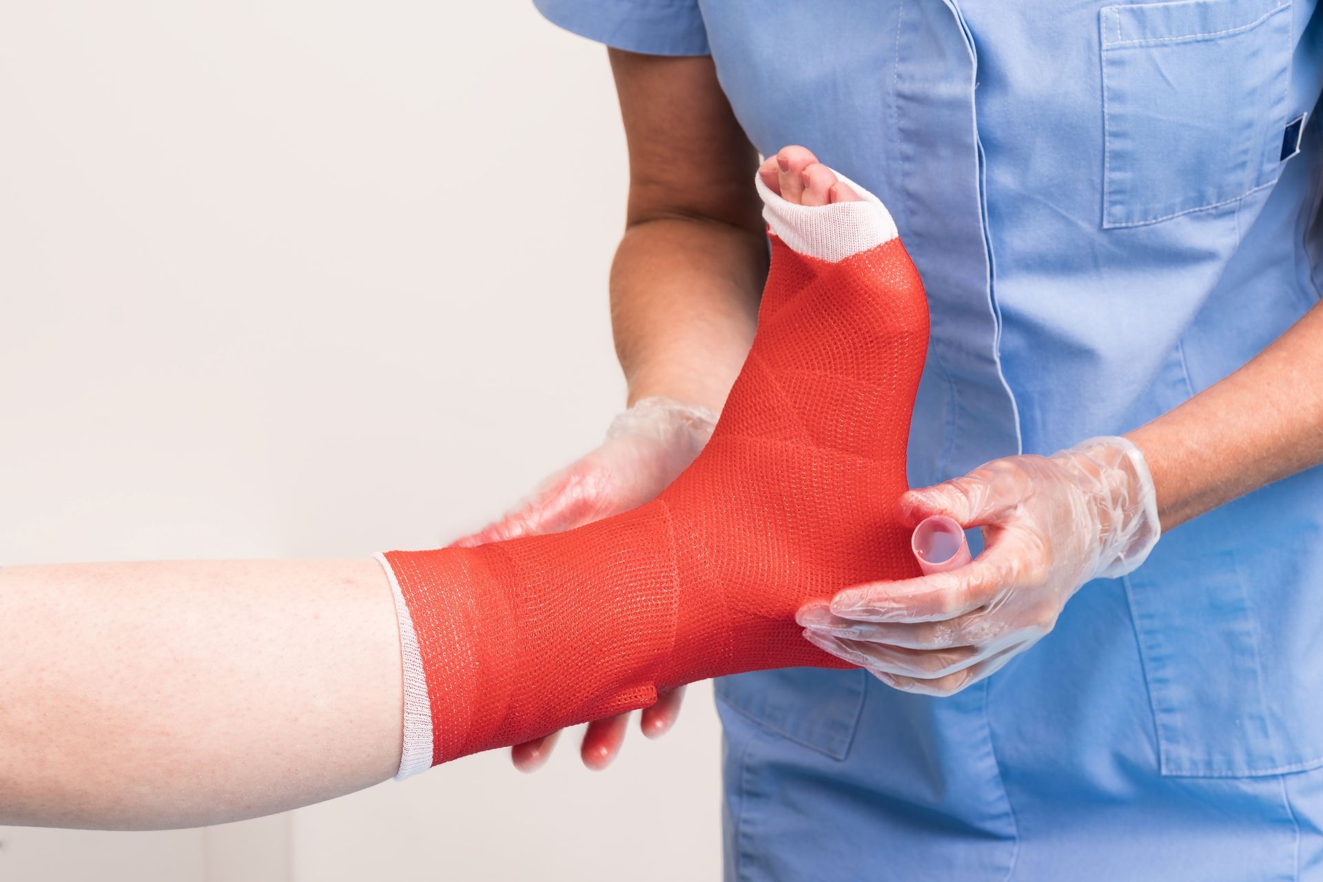 Foot in a bright red cast being held by a person in blue scrubs and gloves.