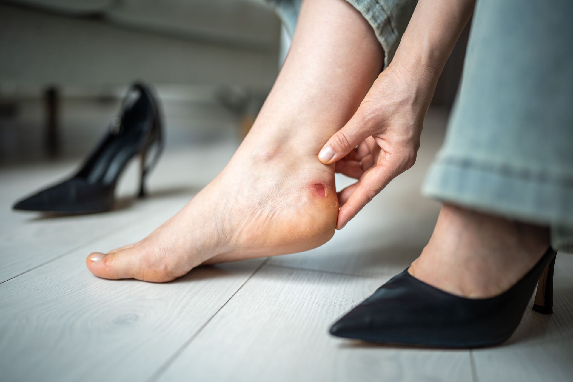 Person with high heels, examining blister on heel of foot. Black heels in background.