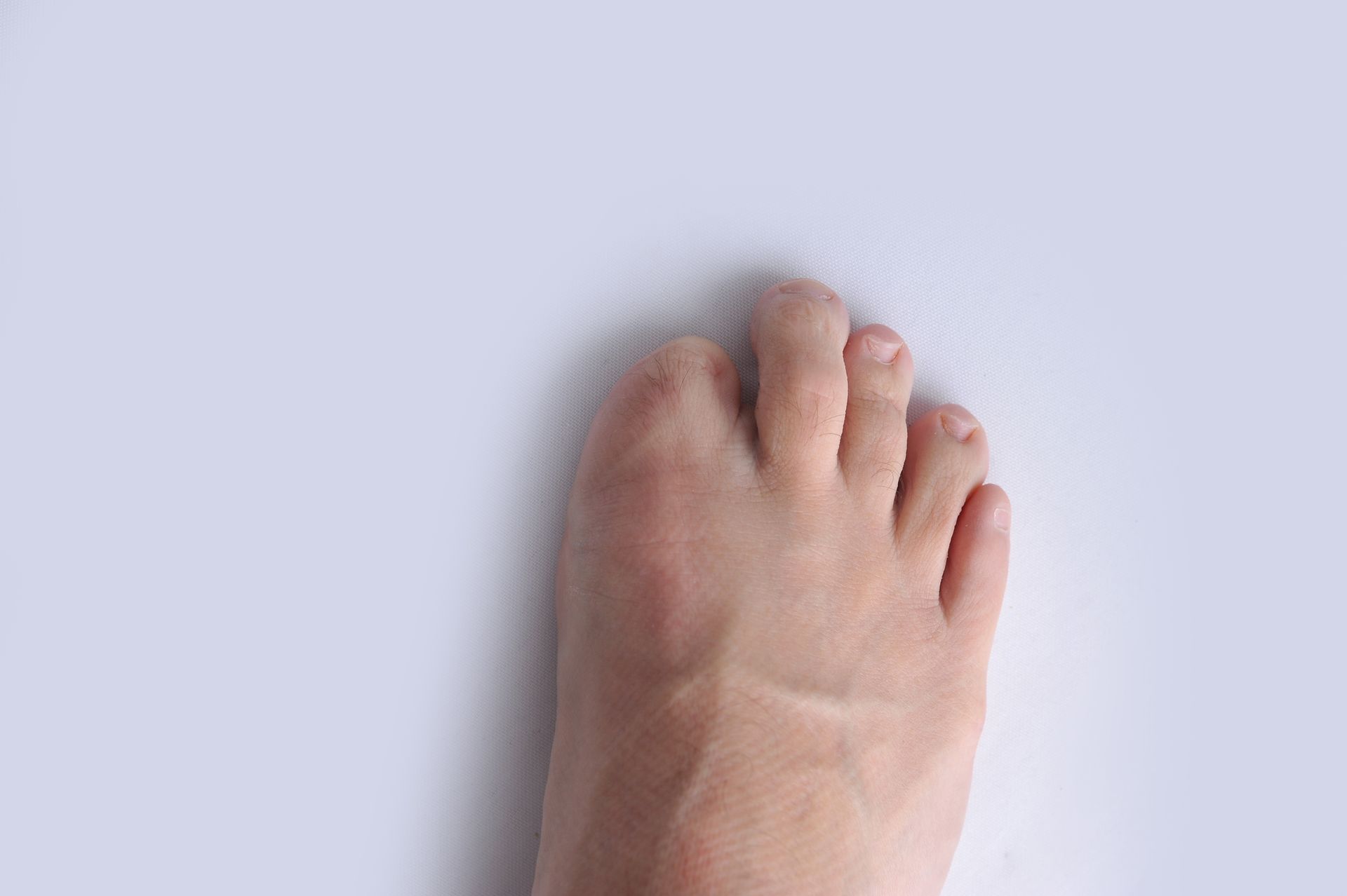Bare foot on a white background, toes pointing upwards.
